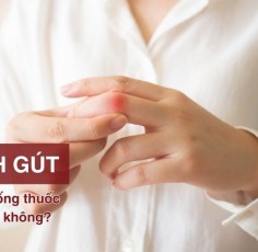 [Tư vấn] Bệnh “Gút” có nên uống thuốc giảm đau không?